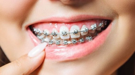 Tratamentos de ortodontia
